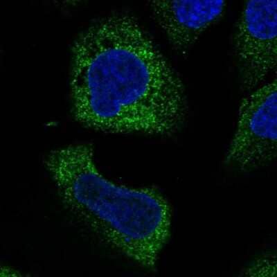 Immunocytochemistry/ Immunofluorescence: WISP3 Antibody [NBP2-56060]