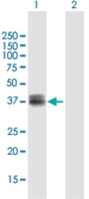 Western Blot: WISP3 Antibody [H00008838-B01P-50ug]