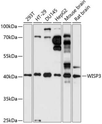 Western Blot: WISP3 AntibodyAzide and BSA Free [NBP2-93872]