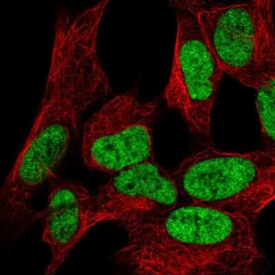 Immunocytochemistry/ Immunofluorescence: WIZ Antibody [NBP2-58557]