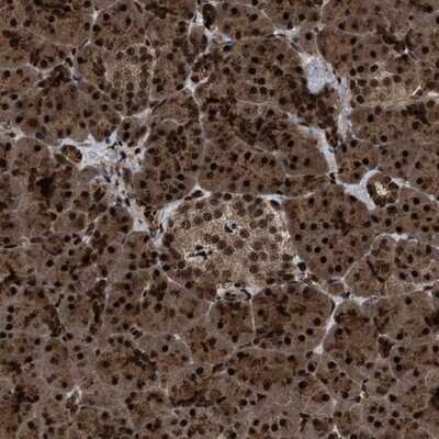 Immunohistochemistry-Paraffin: WIZ Antibody [NBP1-80586]