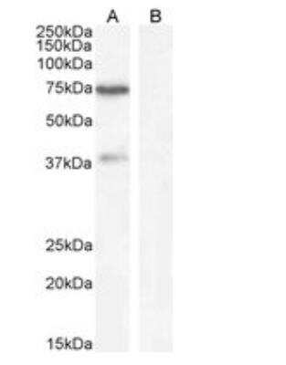 Western Blot: WIZ Antibody [NBP1-21059]