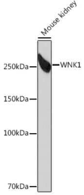 Western Blot: WNK1 Antibody (6C5S6) [NBP3-16360]