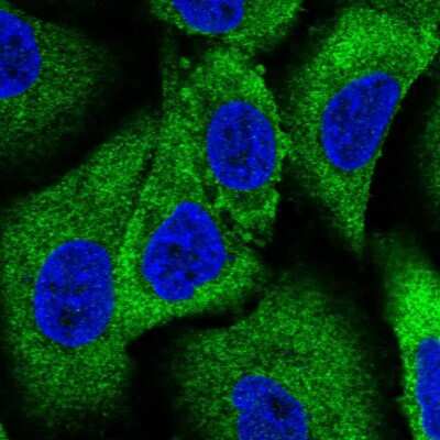 Immunocytochemistry/ Immunofluorescence: WNK1 Antibody [NBP2-58438]