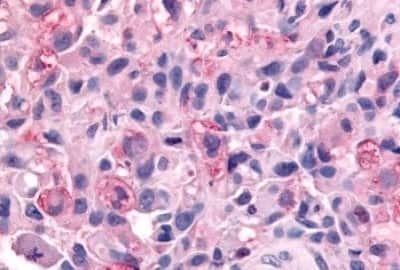 Immunohistochemistry: WNK1 Antibody [NBP3-14518]