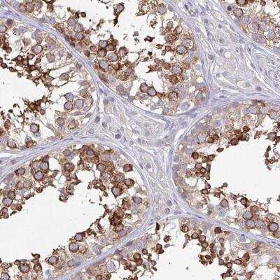 Immunohistochemistry-Paraffin: WNK1 Antibody [NBP2-32434]