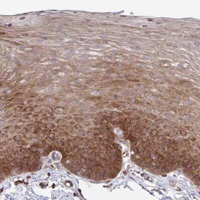 Immunohistochemistry-Paraffin: WNK1 Antibody [NBP2-32434]