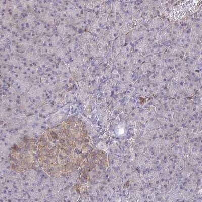 Immunohistochemistry-Paraffin: WNK1 Antibody [NBP2-32434]