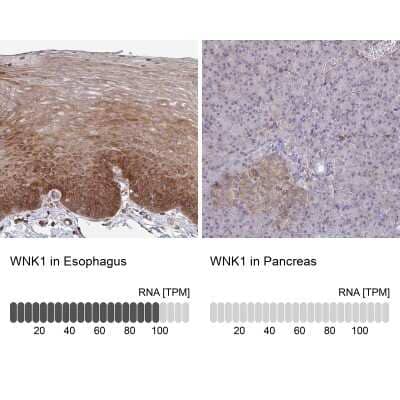 Immunohistochemistry-Paraffin: WNK1 Antibody [NBP2-32434]