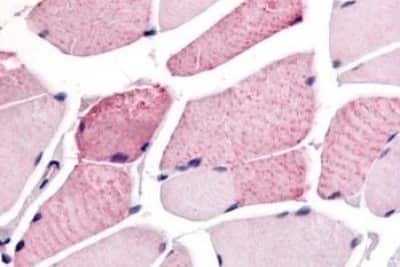 Immunohistochemistry-Paraffin: WNK1 Antibody [NBP3-14518]