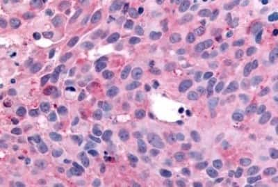 Immunohistochemistry-Paraffin: WNK1 Antibody [NBP3-14518]