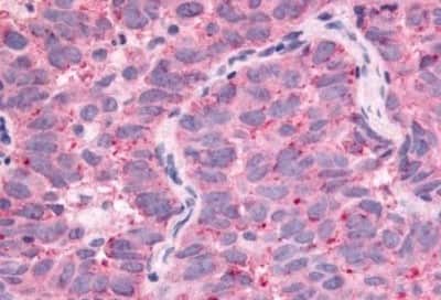 Immunohistochemistry-Paraffin: WNK1 Antibody [NBP3-14518]
