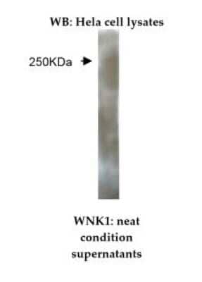 Western Blot: WNK1 Antibody (M42-P3B10)BSA Free [NBP2-50364]