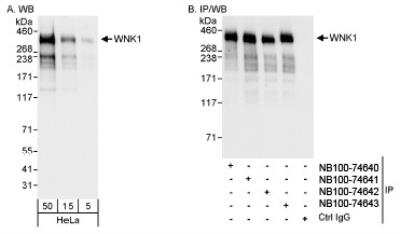 Western Blot: WNK1 Antibody [NB100-74641]