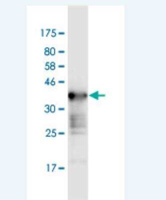 Western Blot: WNK2 Antibody (2A2) [H00065268-M02]