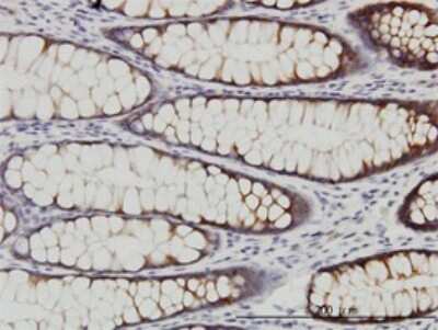 Immunohistochemistry-Paraffin: WNK2 Antibody (2E10) [H00065268-M01]