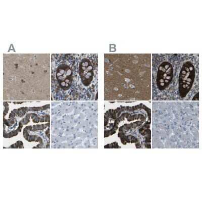 Immunohistochemistry-Paraffin: WNK2 Antibody [NBP2-33875]