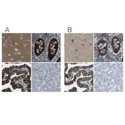 Immunohistochemistry-Paraffin: WNK2 Antibody [NBP2-33876]