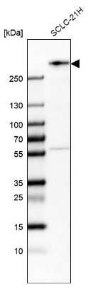 Western Blot: WNK2 Antibody [NBP2-33876]