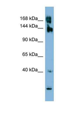 Western Blot: WNK3 Antibody [NBP1-58361]