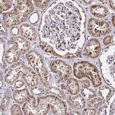 Immunohistochemistry: WNK4 Antibody [NBP1-92597]