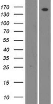 Western Blot: WNK4 Overexpression Lysate [NBP2-06033]