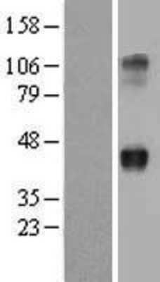 Western Blot: Wnt-2 Overexpression Lysate [NBL1-17866]