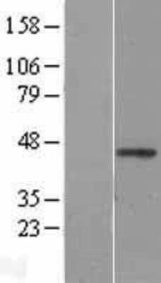 Western Blot: Wnt-2b Overexpression Lysate [NBL1-17868]