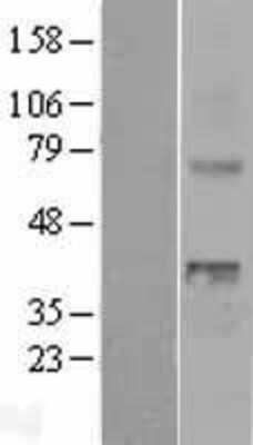 Western Blot: Wnt-4 Overexpression Lysate [NBL1-17871]