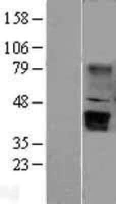 Western Blot: Wnt-5b Overexpression Lysate [NBL1-17873]