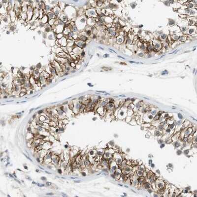 Immunohistochemistry-Paraffin: Wnt-7a Antibody [NBP1-86071]