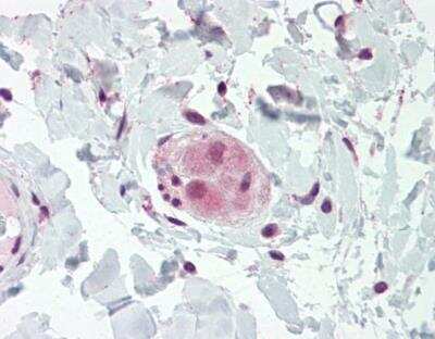 Immunohistochemistry-Paraffin: WRCH1 Antibody [NBP1-33639]