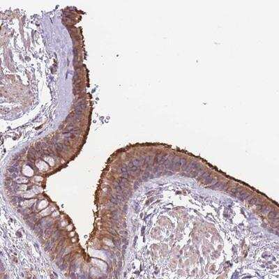 Immunohistochemistry-Paraffin: WRCH1 Antibody [NBP2-13230]