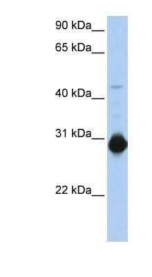 Western Blot: WRCH1 Antibody [NBP1-58350]