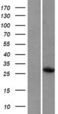 Western Blot: WRCH1 Overexpression Lysate [NBP2-06544]