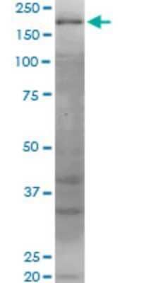 Western Blot: WRN Antibody (2F7) [H00007486-M06]