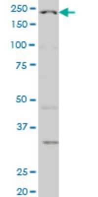 Western Blot: WRN Antibody (3C11) [H00007486-M09]