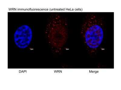 Immunocytochemistry/ Immunofluorescence: WRN Antibody [NB100-471]