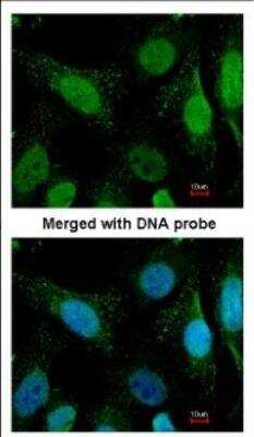 Immunocytochemistry/ Immunofluorescence: WRN Antibody [NBP2-20914]