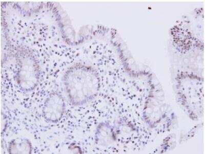Immunohistochemistry-Paraffin: WRN Antibody [NBP1-31895]