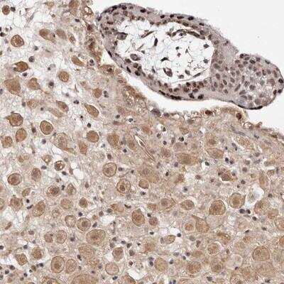 Immunohistochemistry-Paraffin: WRN Antibody [NBP1-87143]