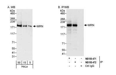 Immunoprecipitation: WRN Antibody [NB100-471]