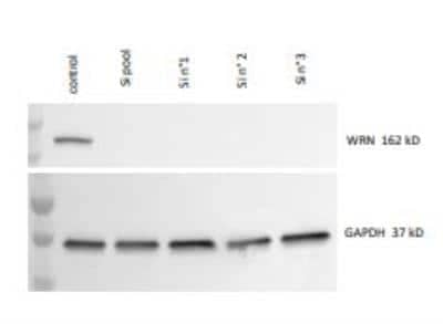 Western Blot: WRN Antibody [NB100-471]