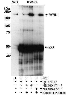 Western Blot: WRN Antibody [NB100-472]