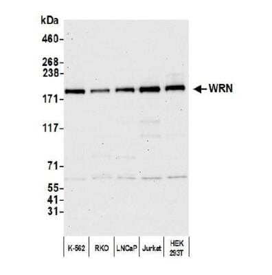 Western Blot: WRN Antibody [NB100-472]