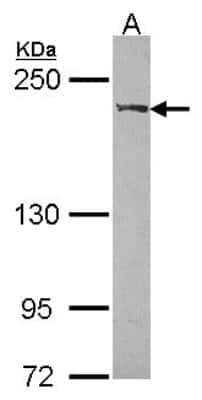 Western Blot: WRN Antibody [NBP1-31895]