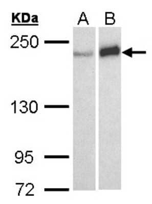 Western Blot: WRN Antibody [NBP2-20914]