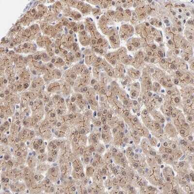 Immunohistochemistry-Paraffin: WSB1 Antibody [NBP1-84162]