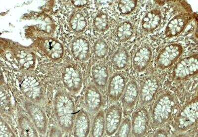 Immunohistochemistry-Paraffin: WSB1 Antibody - BSA Free [NBP2-82049]
