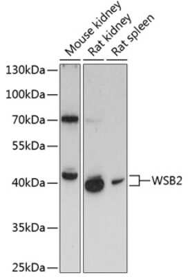 Western Blot: WSB2 AntibodyAzide and BSA Free [NBP2-94083]